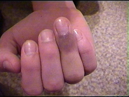 Finger von Alex G.